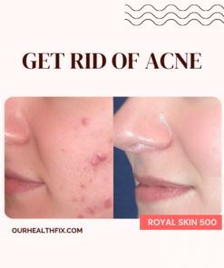 Royal Skin 500 - Get Rid Of Acne, Women Skin Care