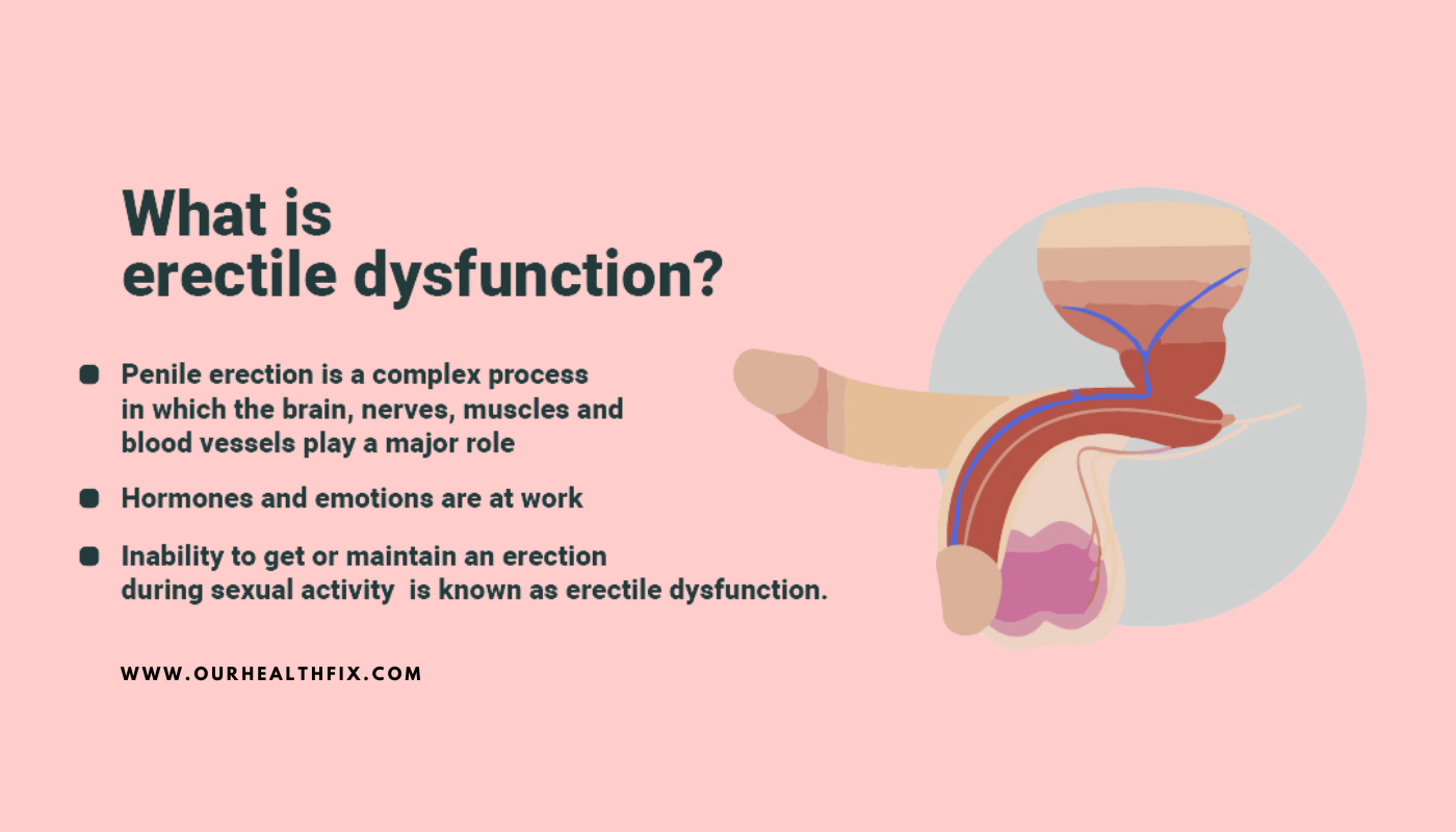 What Is Erectile Dysfunction